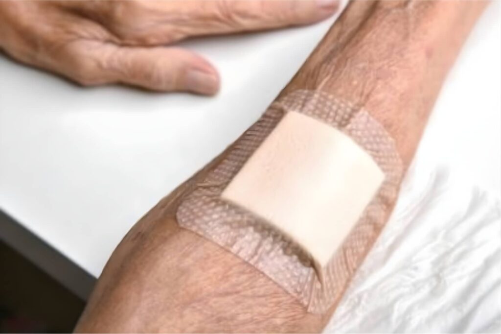 Leczenie i pielęgnacja ran - Woundcare